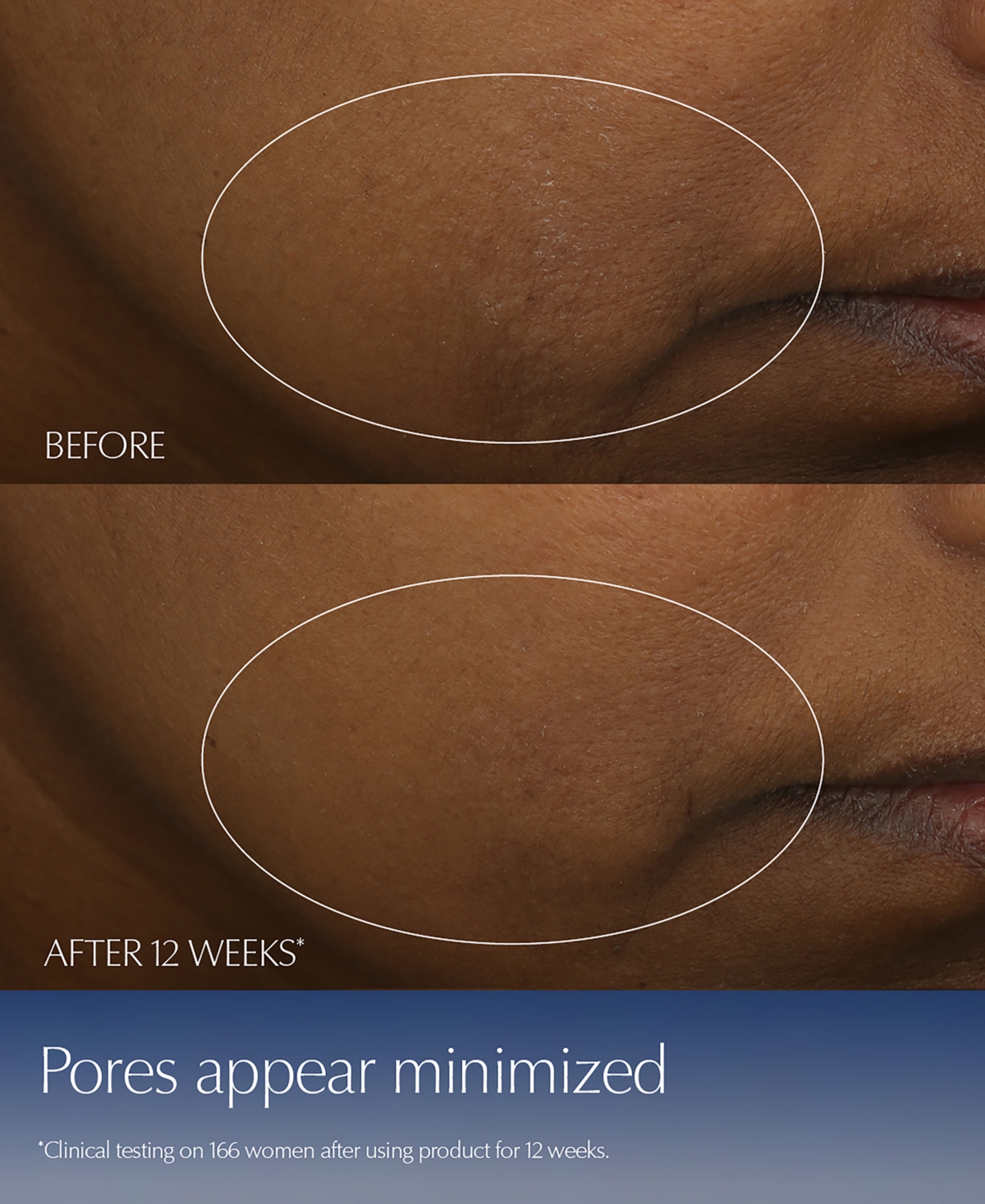 Estee Lauder Limited-Edition Advanced Night Repair Synchronized Multi-Recovery Complex Serum