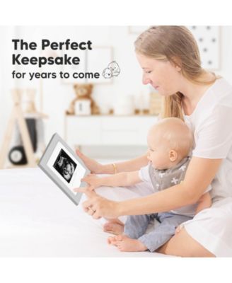 Solo Baby Sonogram Picture Frame, Modern Ultrasound Picture Frames, Pregnancy Announcements Sonogram Frame