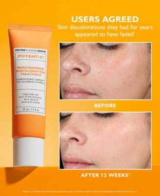 Potent-C Niacinamide Discoloration Treatment, 1.7 oz.
