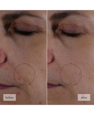 Hope In A Jar Smooth-Glow Multi-Tasking Moisturizer With Pro-Vitamin P, Glycolic & Hyaluronic Acids, 0.5 oz.