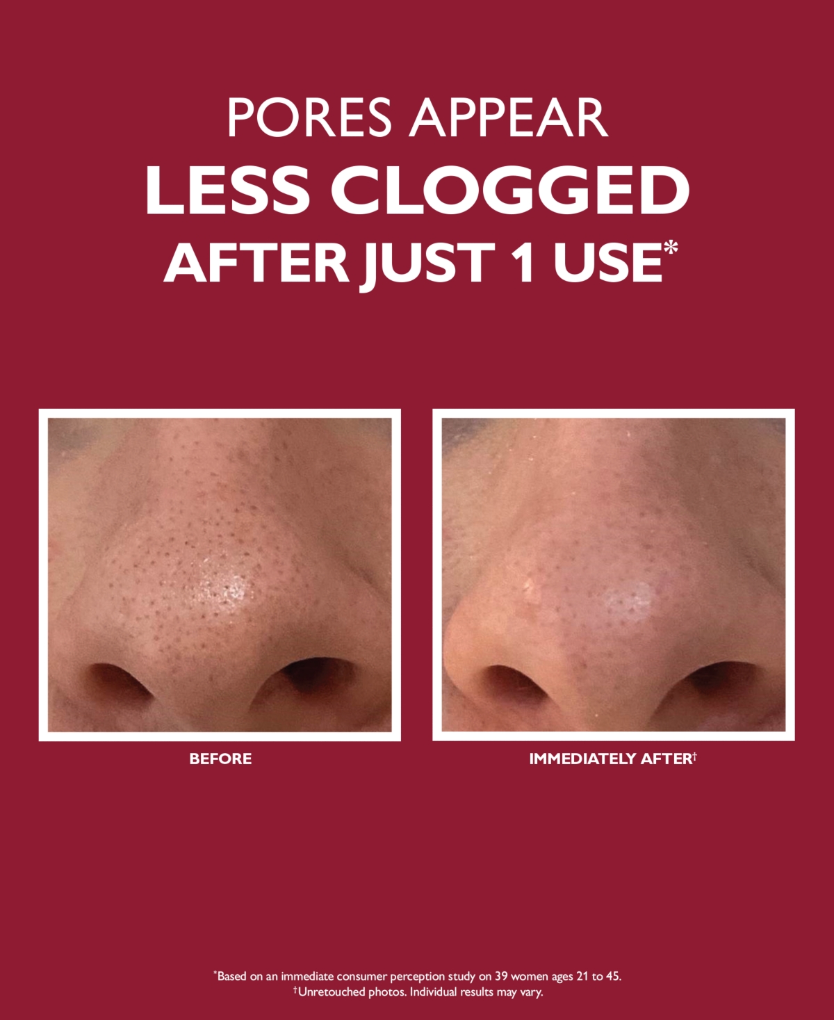 Peter Thomas Roth Even Smoother Microdermabrasion Exfoliating Pore Purifier, 1.7 Oz. In No Color