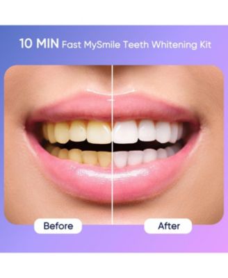 Deluxe 10 Min Teeth Whitening Kit with 28 LED Light, 35% Carbamide Peroxide Teeth Whitening Gel, Helps Remove Years of Stains from Coffee, Soda, Wines, Smoking, Food