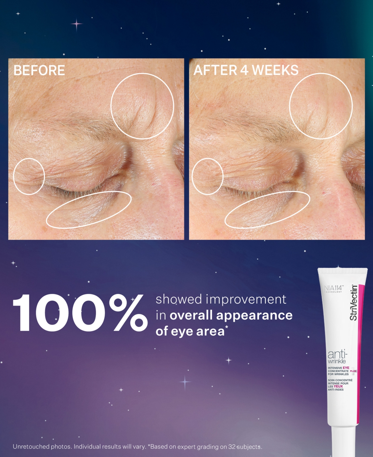 Strivectin 3-pc. Smooth & Plump Skincare Set In No Color