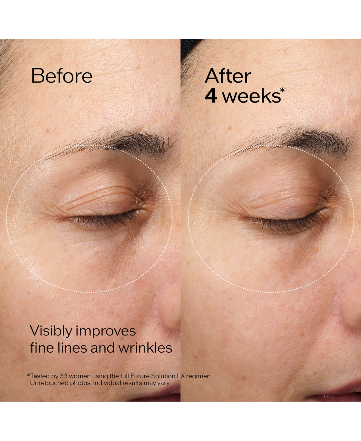 Shiseido Future Solution Lx Eye And Lip Contour Regenerating Cream In No Color