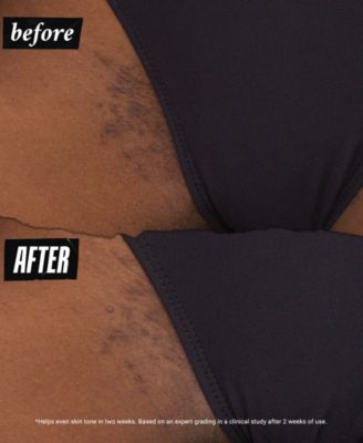 Ingrown Hair & Tone-Correcting Intimate Drops