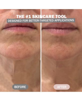 7 Color LED Neck and Face Beauty Device - Limited Edition