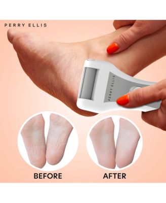 CORDLESS CALLUS REMOVER