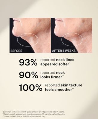 Peptight Tightening Neck Serum Roller, 1.7 oz.