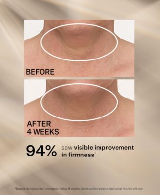 TL Advanced Tightening Neck Cream Plus With Alpha-3 Peptide, 1.7 oz.