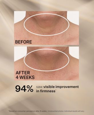 TL Advanced Tightening Neck Cream Plus With Alpha-3 Peptide, 3.4 oz.