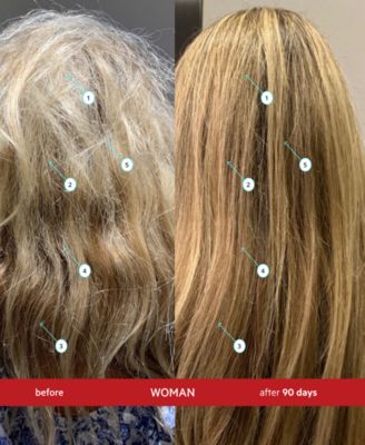 NIA FIX Instant Bond & Cuticle Restructuring System