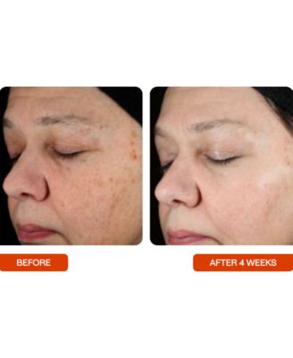 Universal C Skin Refiner Brightening Vitamin C Serum