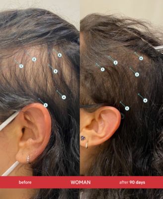 Revita Extra Strength Hair Density Shampoo, 205 ml