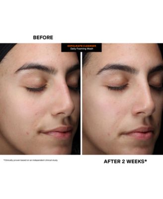 ExfoliKate Cleanser Daily Foaming Wash, 4 oz.