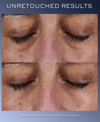 G&eacute;nifique Ultimate Eye Cream, 0.68 oz.