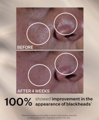 Super Shrink Pore Minimizing Serum