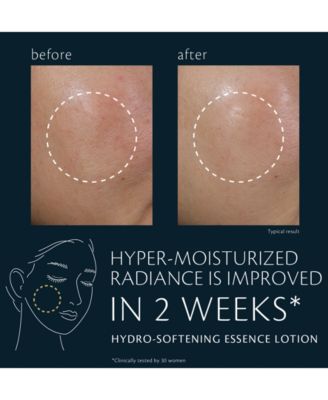 Hydro-Clarifying Essence Lotion Refill, 5.7 oz.