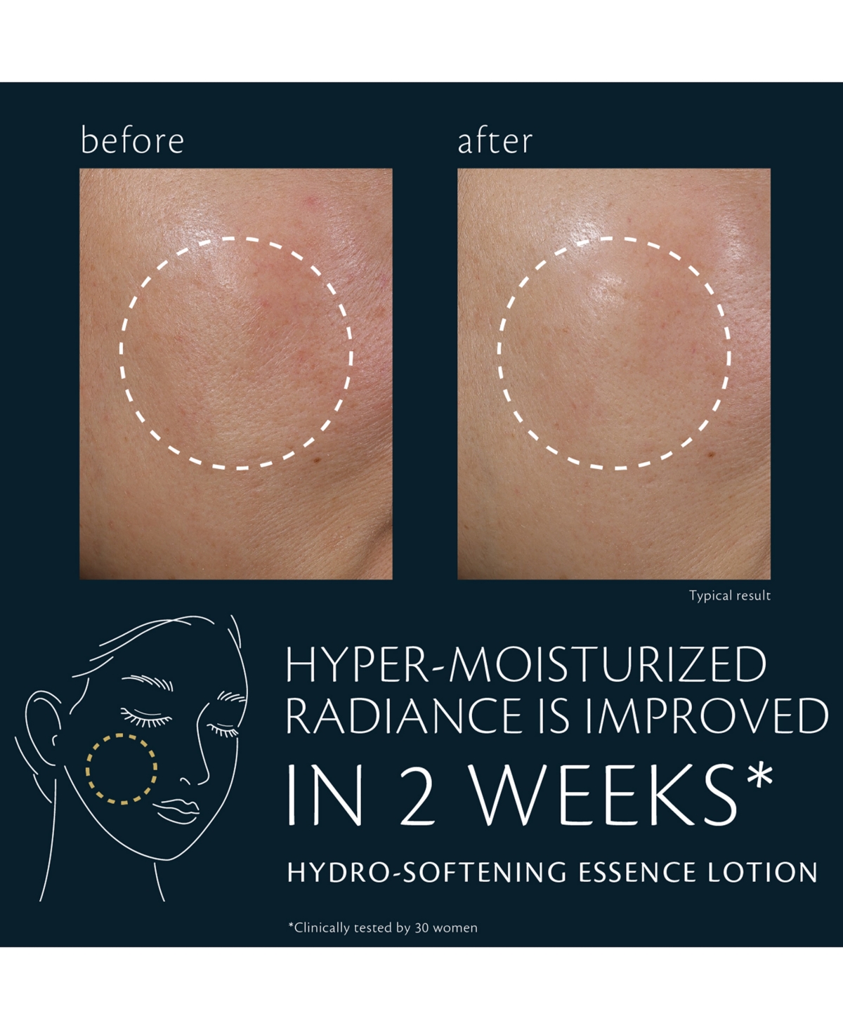 Clé De Peau Beauté Cle De Peau Beaute Hydro Clarifying Essence Lotion Refill 5.7 Oz. In Transparent