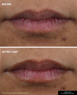 HydraKate Lip Oil Elixir, 0.24 oz.