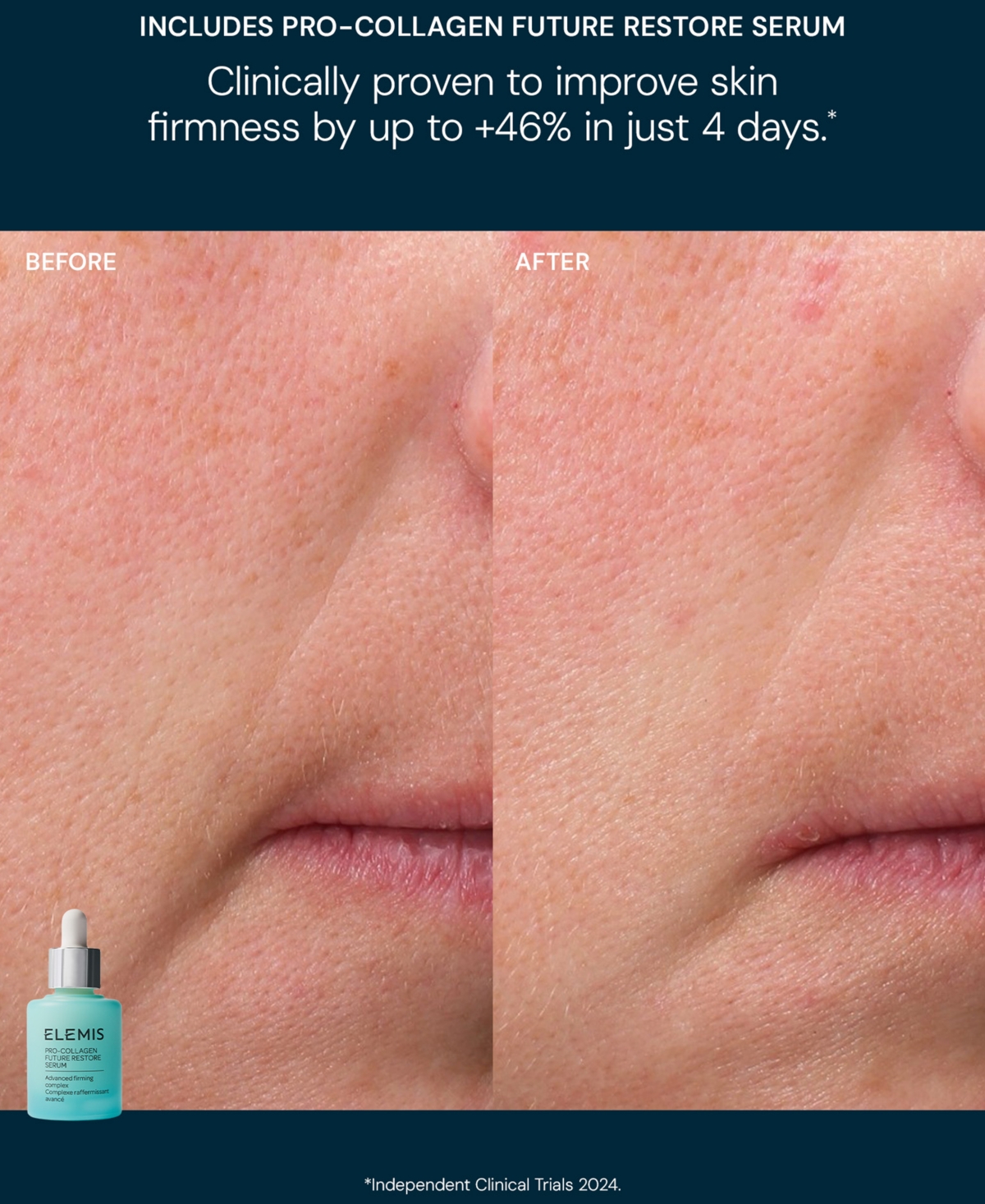 Elemis The Magic Of Pro-collagen Complete Routine Skincare Set In Transparent