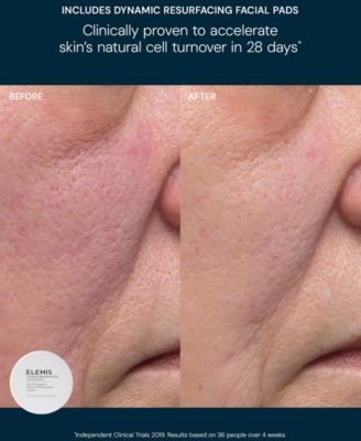 2-Pc. Glow Bright Resurfacing Set