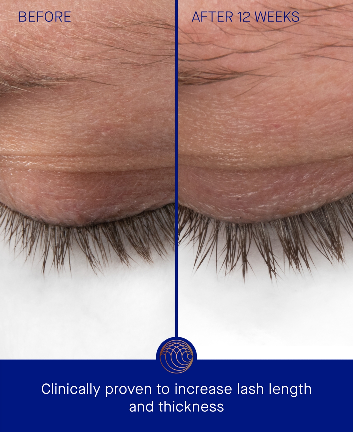 Augustinus Bader The Eyebrow & Lash Enhancing Serum