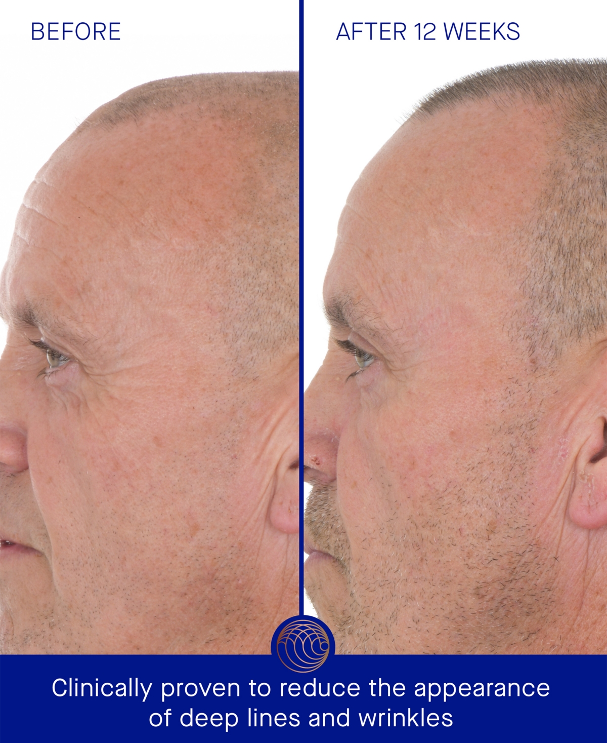 Augustinus Bader The Retinol Serum, 1.01 oz.