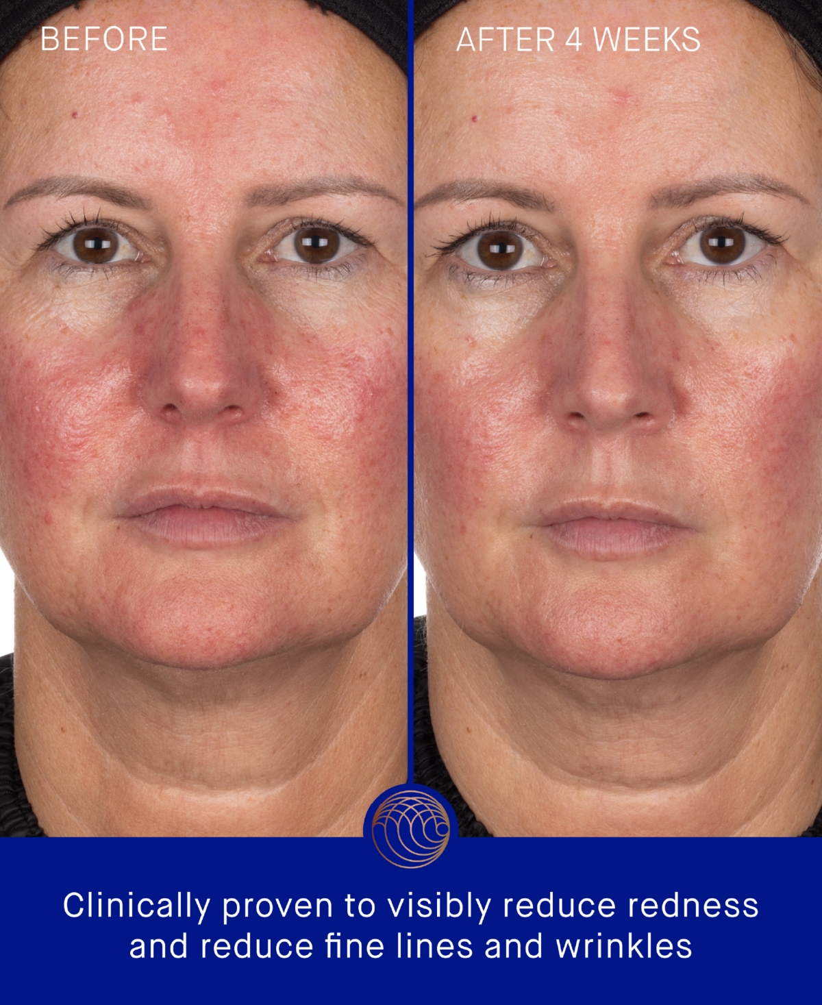 Augustinus Bader 6-Pc. The Hydrogel Face Mask Pack, 1 oz.