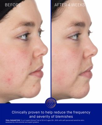 The Foaming Cleanser, 3.4 oz.