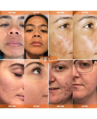 Korean Skin Care Vitamin C Serum Day Glow Serum - Anti Aging Anti Wrinkle K Beauty Skincare