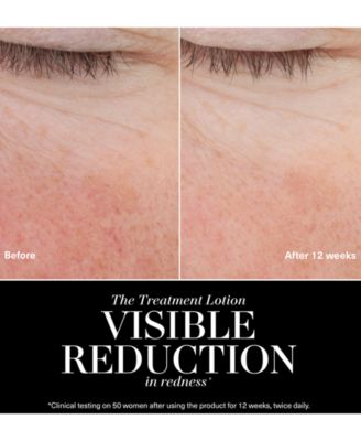 The Treatment Jumbo Lotion, 3.39 oz.