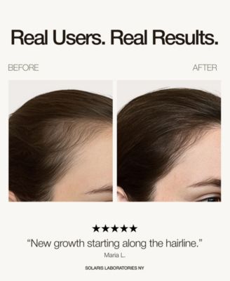 Red LED Light therapy Hair Growth Cap