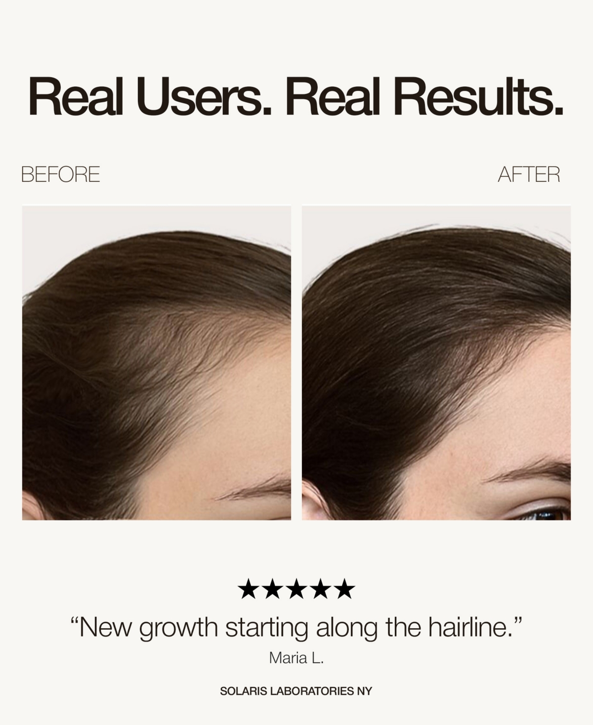 Solaris Laboratories Ny Red Led Light therapy Hair Growth Cap