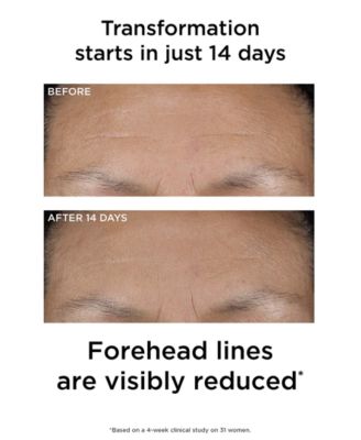 PREVAGE 3-in-1 Reset Serum, 1 oz.