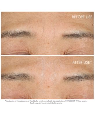 Capture Totale Hyalushot Wrinkle Corrector with Hyaluronic Acid