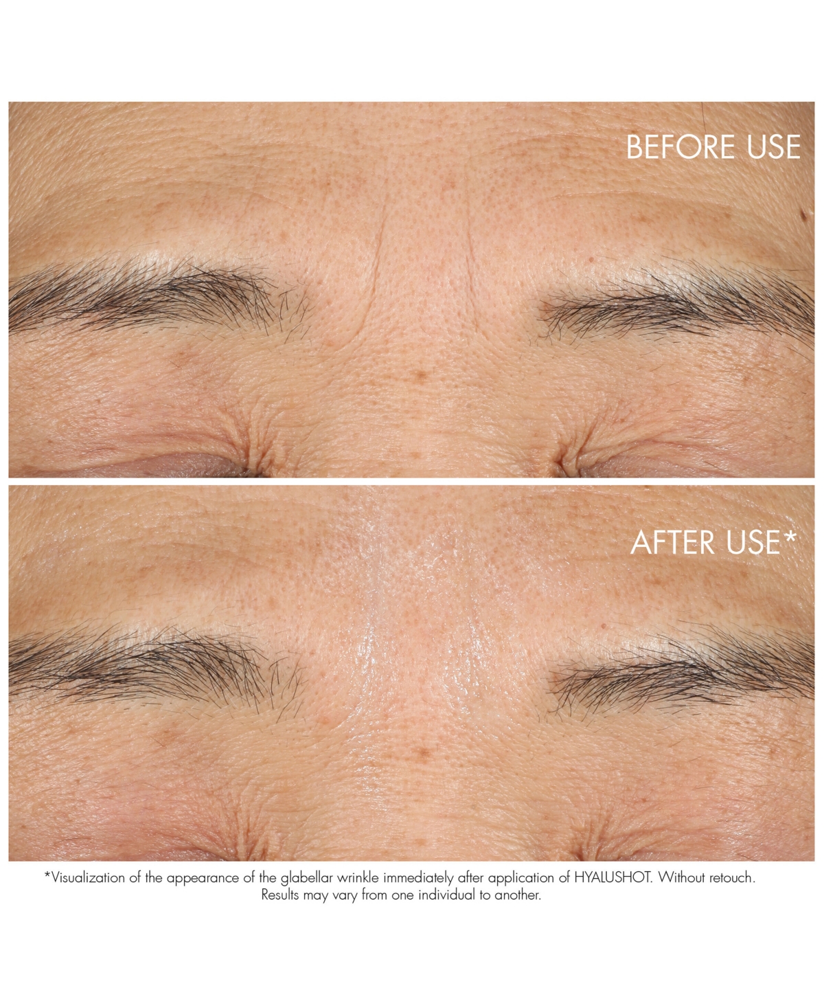 Capture Totale Hyalushot Wrinkle Corrector with Hyaluronic Acid