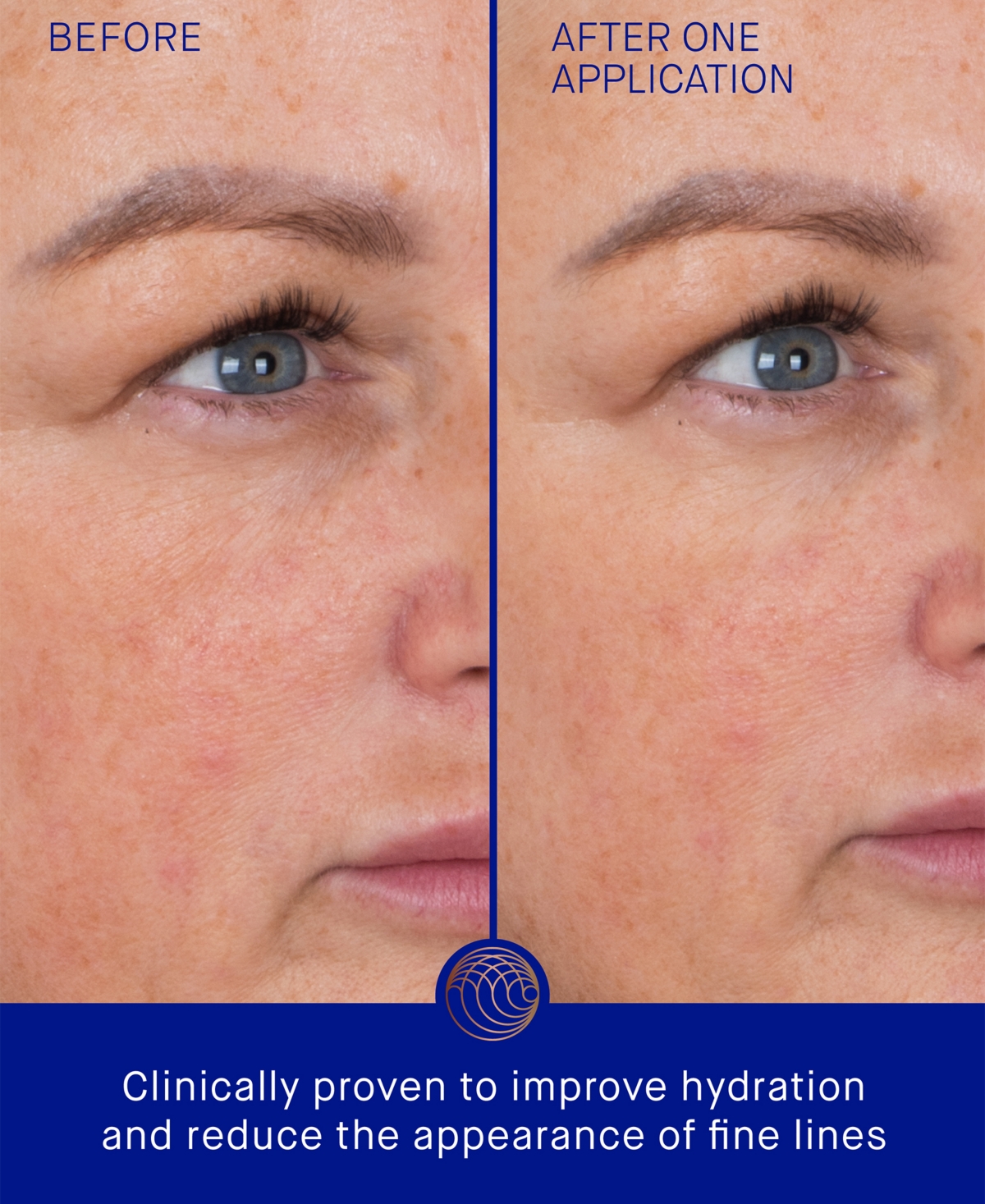 Augustinus Bader The Eye Patch Bundle, 3-Pack