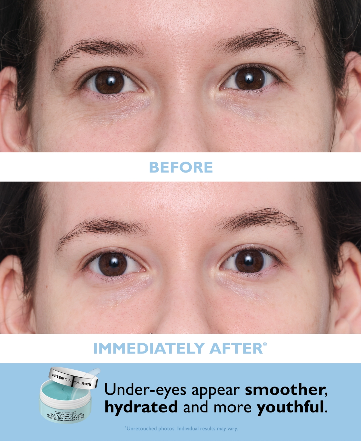 Peter Thomas Roth 2-Pc. Water Drench Recovery Kit