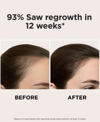 Intensive LED Red Light Therapy Headband