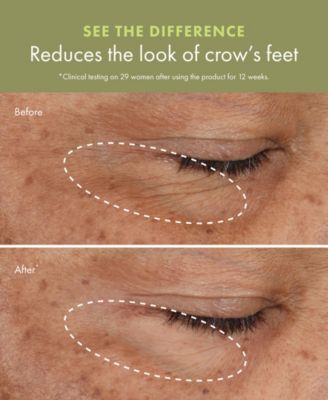 Plantscription™ Wrinkle Correction Eye Cream with Encapsulated Retinol