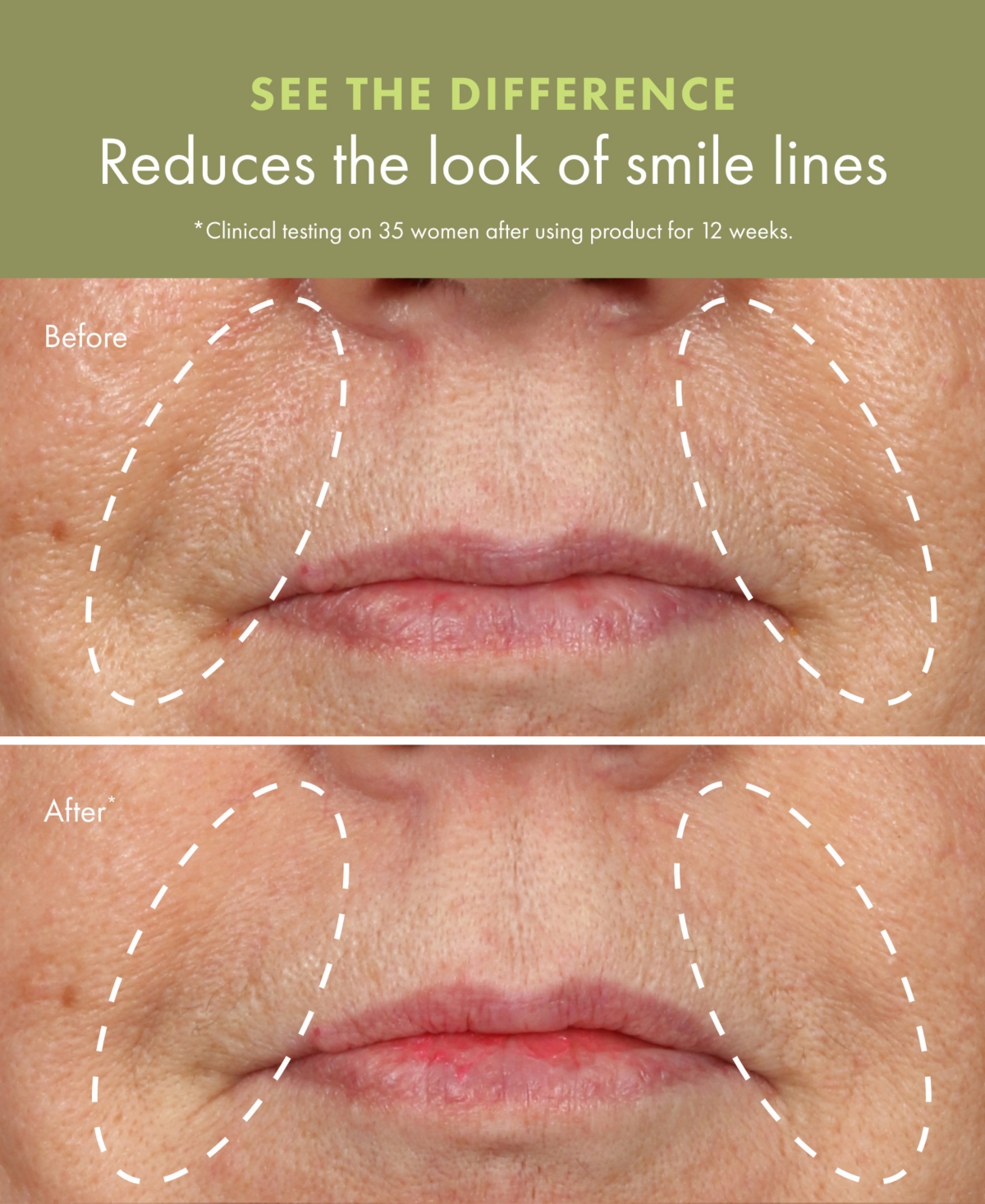 Origins Plantscription Active Wrinkle Correction Serum