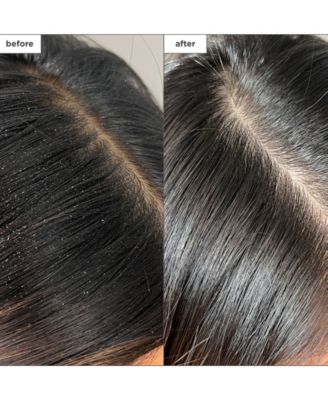 Scalp Revival Charcoal + Tea Tree Buildup Detox Spray, 4 oz.