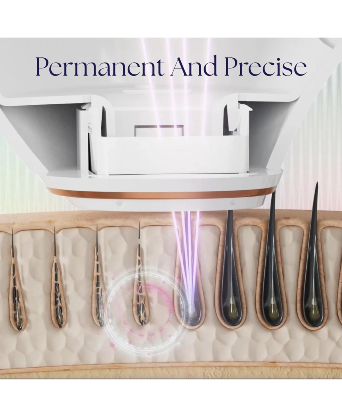 Epilaser 808 Laser Hair Removal Device for Light to Medium Skin Tones