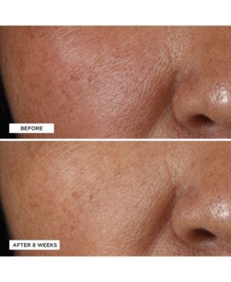 Vitamin C Ester Brightening Amine Face Lift, 2 fl. oz.