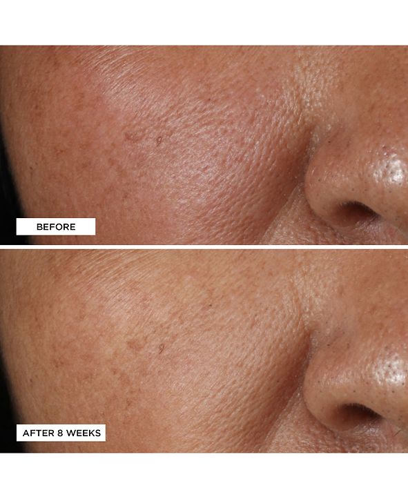 Perricone MD Vitamin C Ester Brightening Amine Face Lift, 2 fl. oz