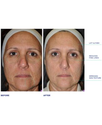 Renew Kick Duo, Created for Macy's