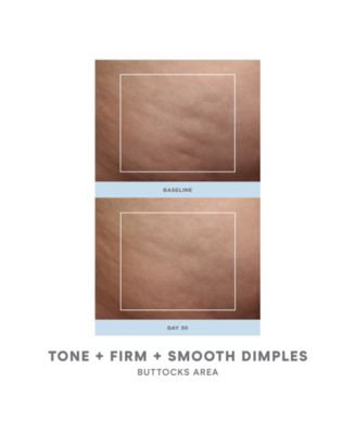 2-Pc. NuBODY Skin Toning Device Set