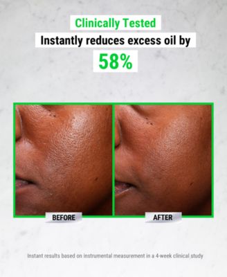 Ultra Pure High-Potency 5.0% Niacinamide Serum, 1 oz.