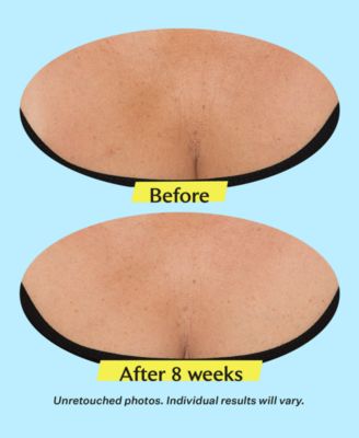 TL Advanced Tightening Neck Cream Plus With Alpha-3 Peptide, 1.7 oz.