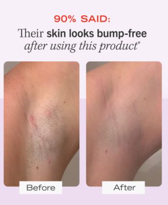 Ingrown Hair Pads With BHA & AHA, 60 pads 